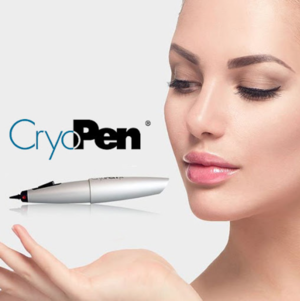 Clinical Treatments. cryo pen 