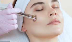Treatments for the Face . microdermabrasion 